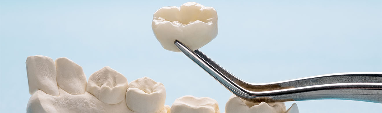 Keramikkronen in Konstanz