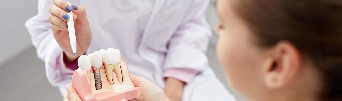 Zahnimplantat in Lindau